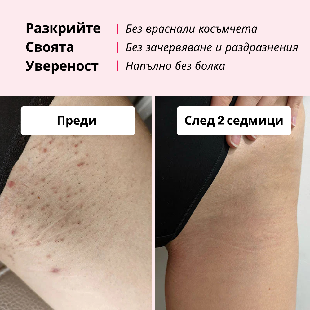 Glowie™ комплект за премахване на косми