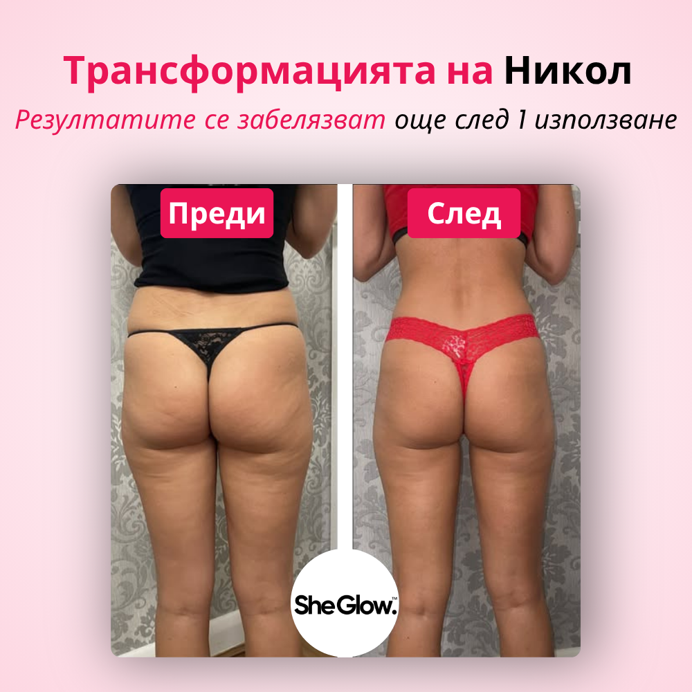 SheGlow™ PRO – комплект за премахване на целулит